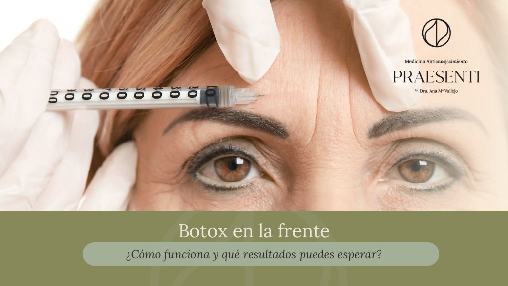 Botox en la frente en Bogotá - clínica estética praesenti clinic