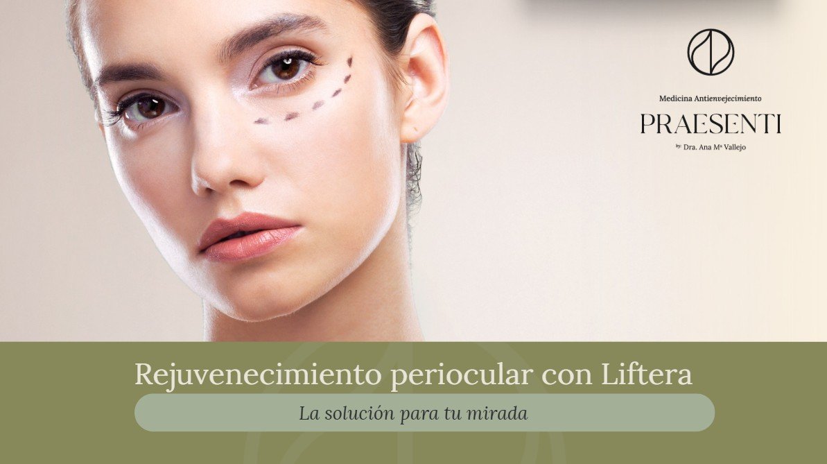 Rejuvenecimiento periocular con liftera-Praesenti