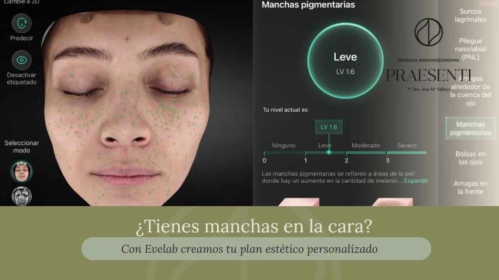 Diagnóstico para manchas en la cara con evalab en Bogotá - Clínica estética Praesenti 2