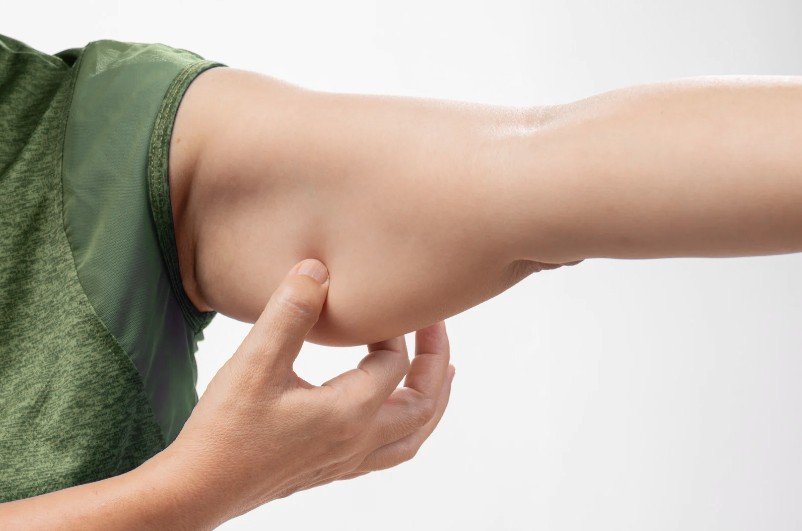 Ejercicios para el brazo de tía y tratamiento médico en Bogotá - Praesenti Clinic