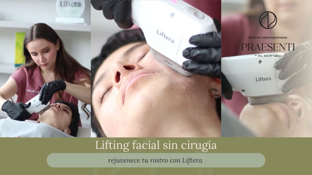 Lifting facial sin cirugía con liftera en Bogotá - Praesenti clinic