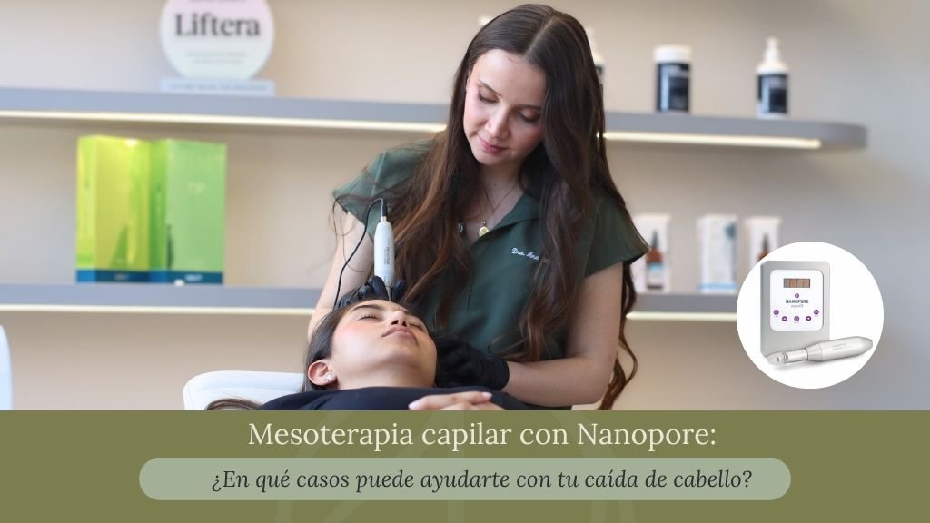 Mesoterapia capilar con nanopore en Bogotá - Clínica estética Praesenti