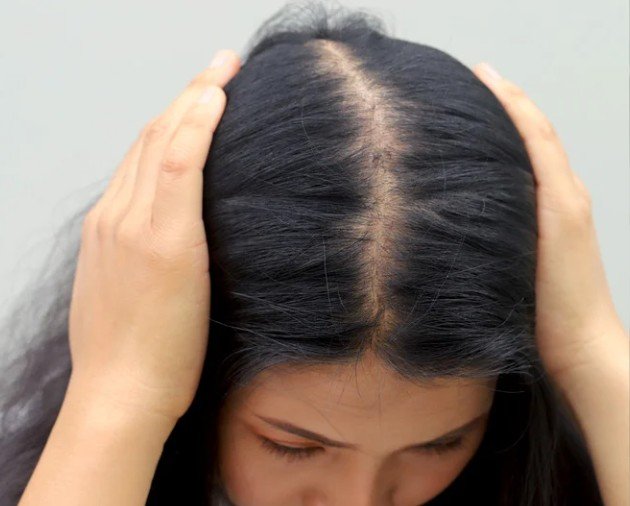 Mesoterapia capilar para la caída del cabello en Bogotá - clínica estética Praesenti