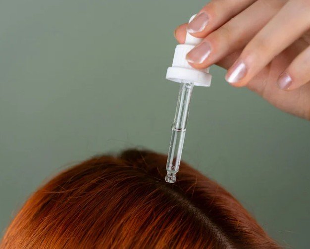 Qué es bueno para la caída del cabello en Bogotá - Mesoterapia capilar - clínica estética Praesenti