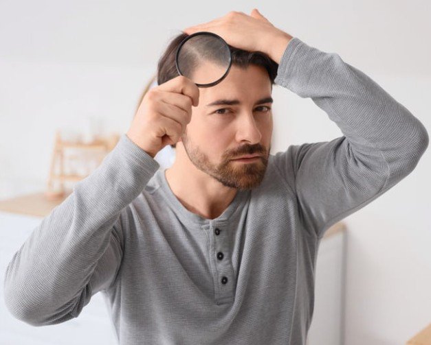 Tratamiento para la caída del cabello en Bogotá - Mesoterapia capilar - clínica estética Praesenti