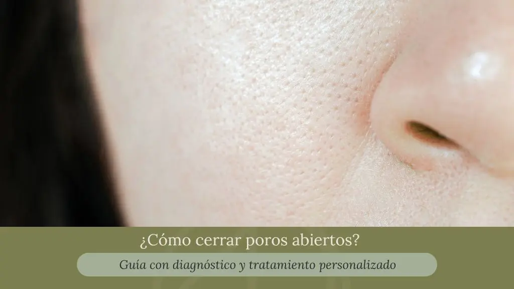 Cómo cerrar poros abiertos - tratamientos en la clínica estética praesenti de Bogotá
