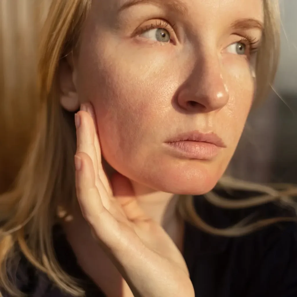 Cómo quitar los poros abiertos de la cara - tratamiento en la clínica estética Praesenti de Bogotá