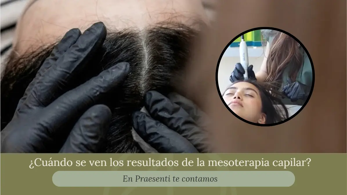 ¿Cuándo se ven los resultados de la mesoterapia capilar? - Praesenti