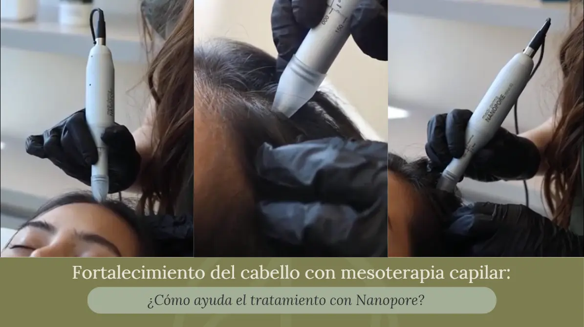 Fortalecimiento del cabello con mesoterapia capilar - Praesenti