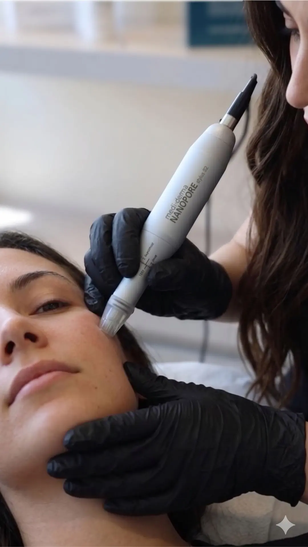 Tratamiento para los poros abiertos con Nanopore en Bogotá - Praesenti Clinic